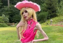 29-річна дівчина важить усього 38 кілограмів при зрості у 180 см: фоловери дали блогерці кілька порад Дівчина важить усього 38 кг